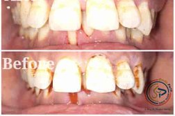 Smile Path Dental Clinic - Dr. Sourabh Gupta Photo