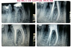 Noble dental solution in Indore